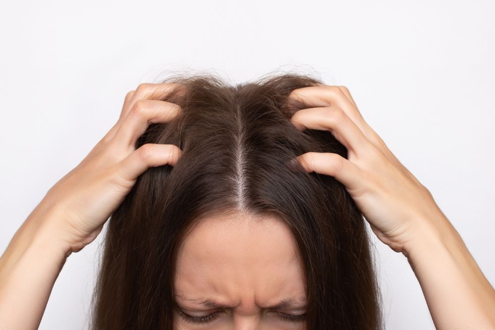 Understanding Scalp Psoriasis Relief Shampoos